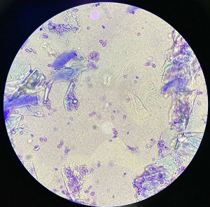 ear-mites-vs-ear-infection