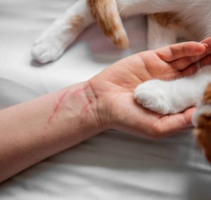 allergic-to-cat-scratch